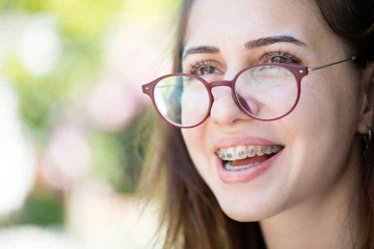 What Are Power Chains For Braces
